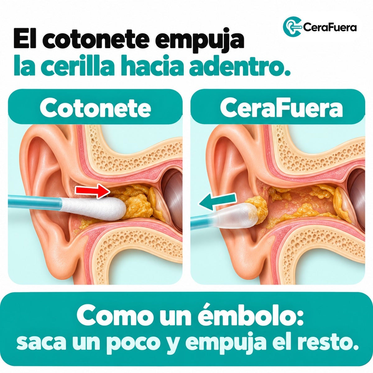 El cotonete empuja la cerilla
